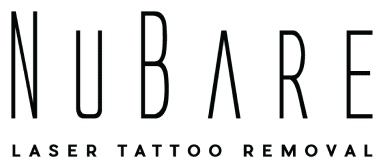 NuBare Laser Tattoo Removal